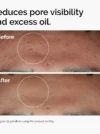 The Ordinary Niacinamide 10% + Zinc 1% - Image 3